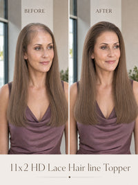 Model wearing taupe lace hairline topper, before-and-after front view