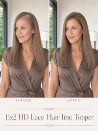 Hair topper on styled bob with straight light brown hair and visible V-shaped hairline