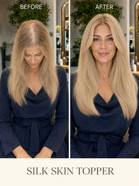 Silk skin hair topper before-and-after: fuller ash-blonde hair on a model.
