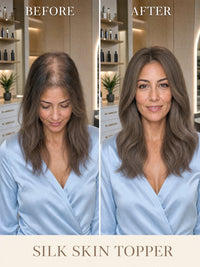 Silk skin hair topper worn by model, shoulder-length wavy hair in medium ash brown