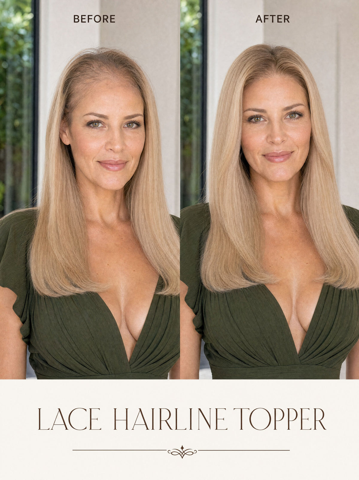 Lace hairline topper worn by model, before-and-after with blonde hair