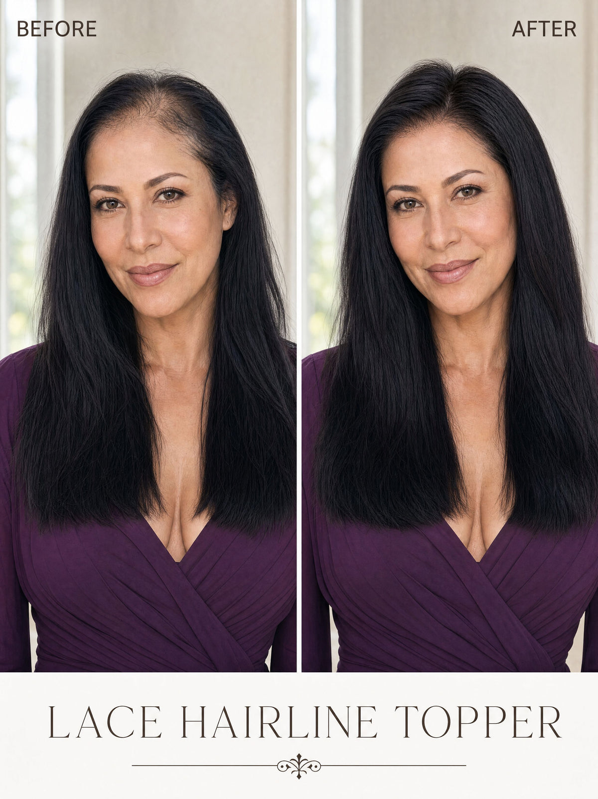 Lace hairline topper before-and-after with dark black hair, model wearing it