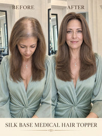 Silk Base medical hair topper on model, before-and-after lighter hair to brown style.