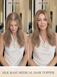 Silk Base medical hair topper on model, before-and-after light hair to beige-blend style.