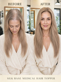 Medical hair topper comparison on model, long straight light-brown hair blended naturally