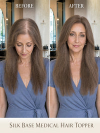 Silk base medical hair topper results showing medium-brown hair before and after