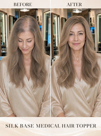 Medical hair topper before-and-after on model, long light-brown hair with seamless blend