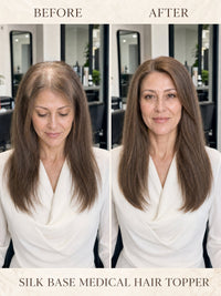 Silk base medical hair topper results: medium-brown coverage before and after