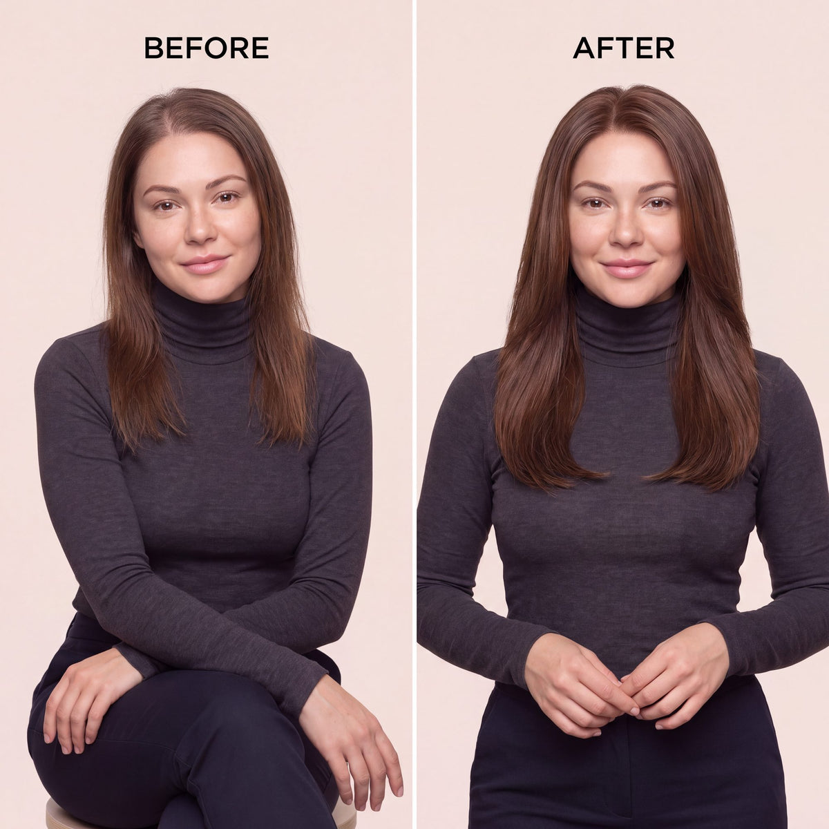 Hairline topper shown on a model, adding fuller brown hair around the front