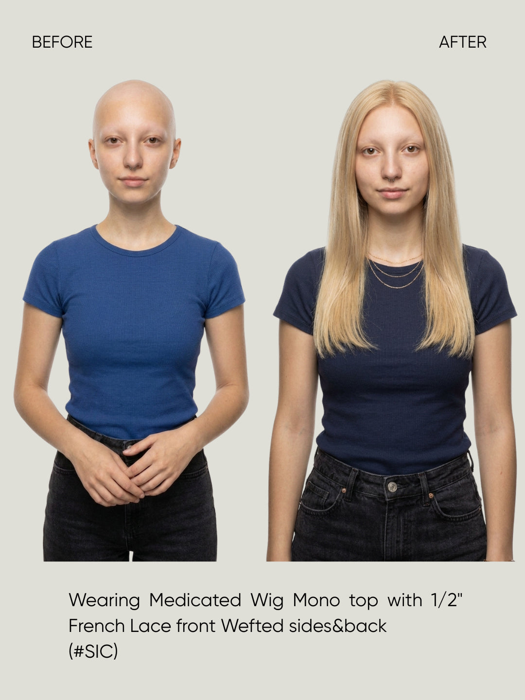 Mono Top with 1/2" French Lace Front and Wefted Sides & Back Medical Wig
