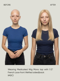 Mono Top with 1/2" French Lace Front and Wefted Sides & Back Medical Wig