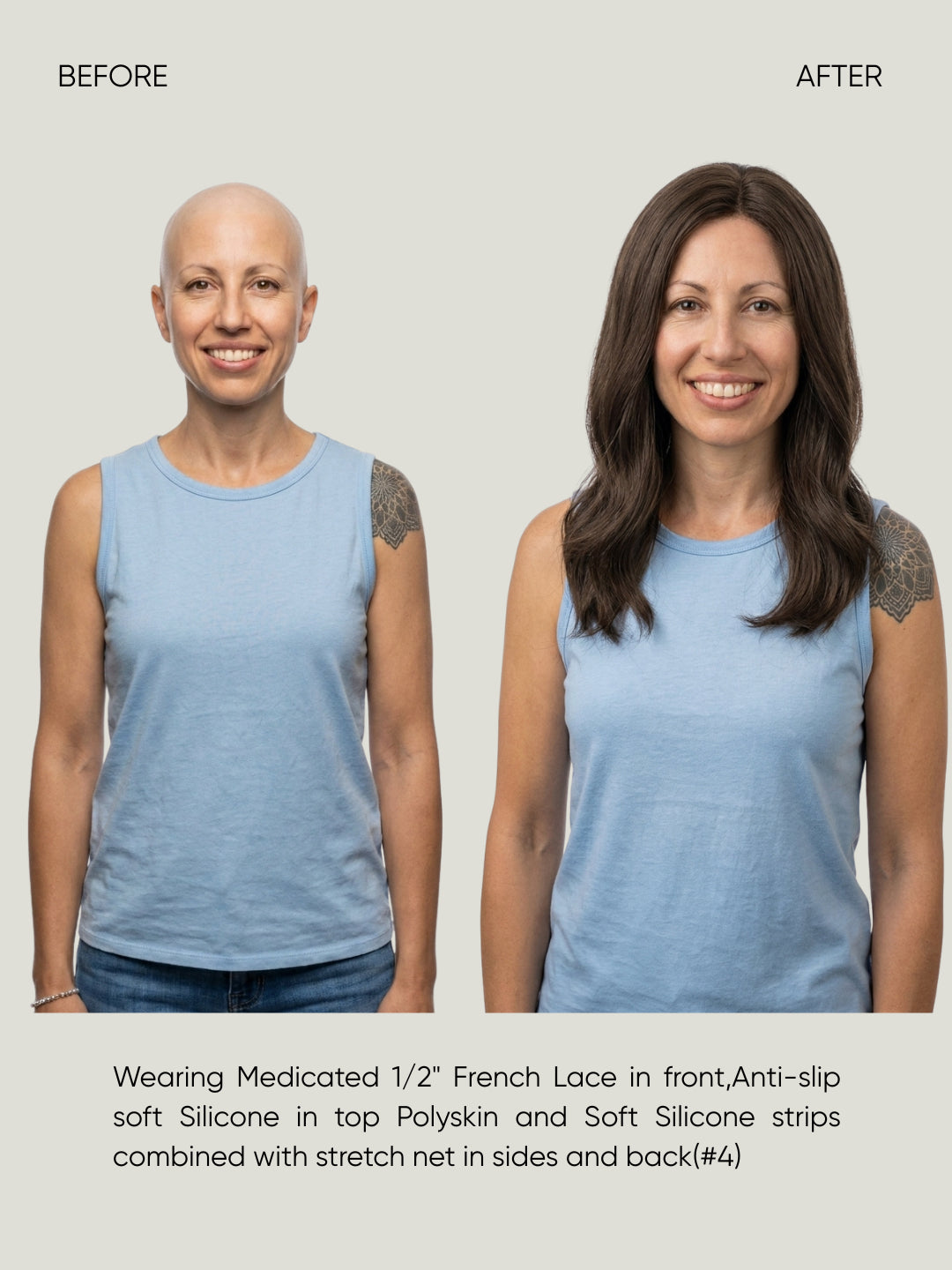 French Lace Silicone Medical Wig