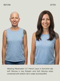 French Lace Silicone Medical Wig