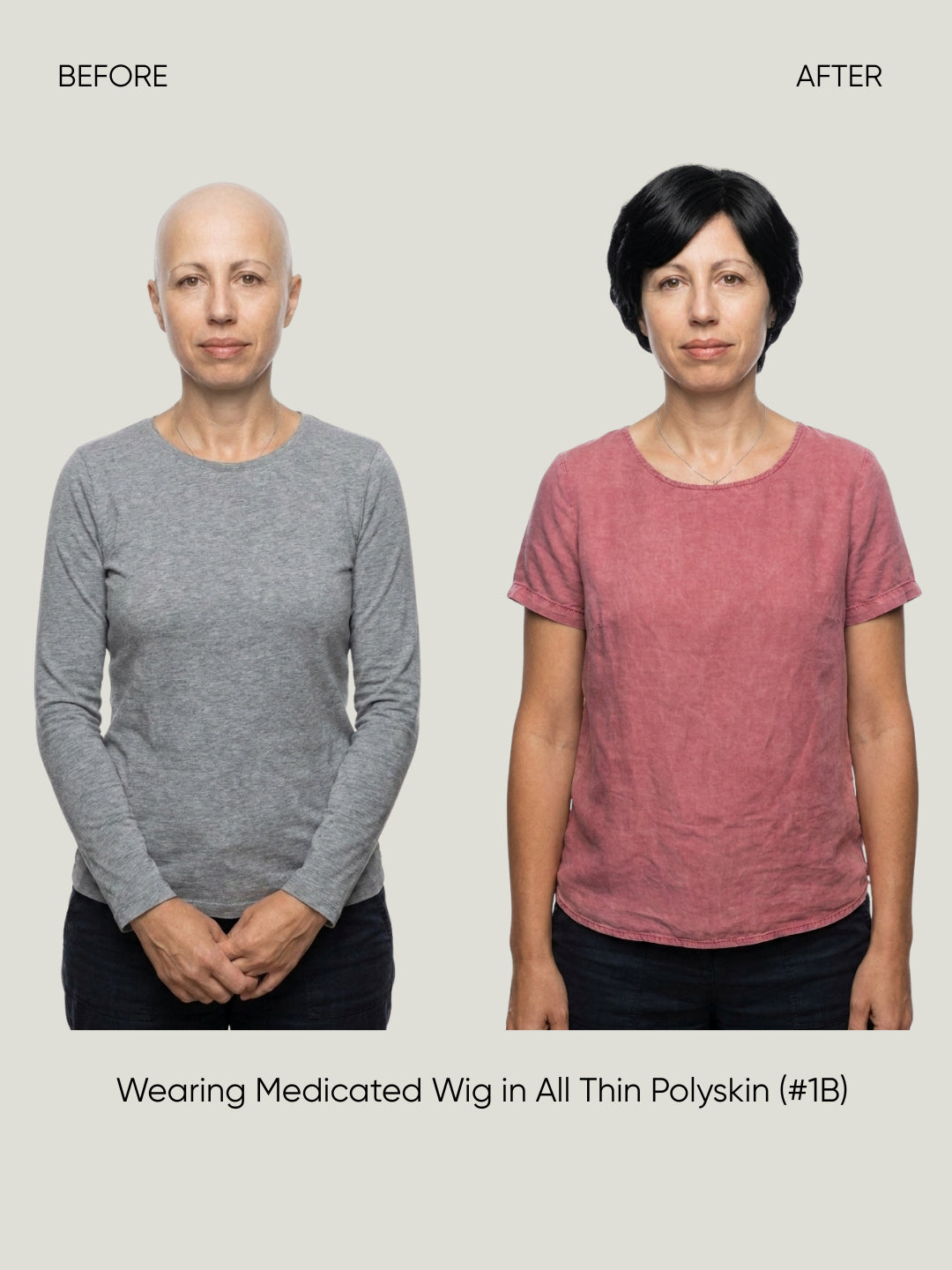 All Thin Polyskin Natural Look Medical Wig