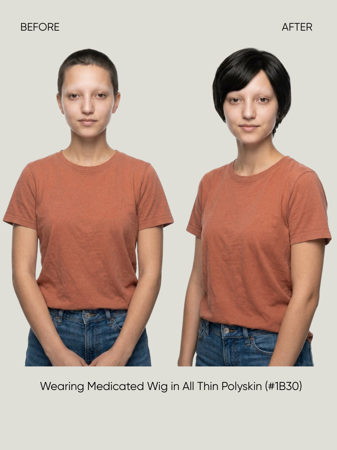 All Thin Polyskin Natural Look Medical Wig