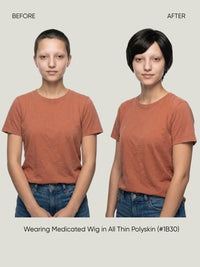 All Thin Polyskin Natural Look Medical Wig