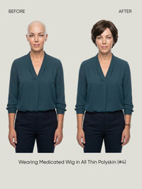 All Thin Polyskin Natural Look Medical Wig