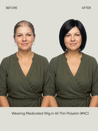 All Thin Polyskin Natural Look Medical Wig