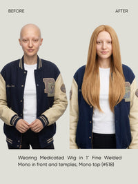 Britta Fine Welded Mono Top Medical Wig
