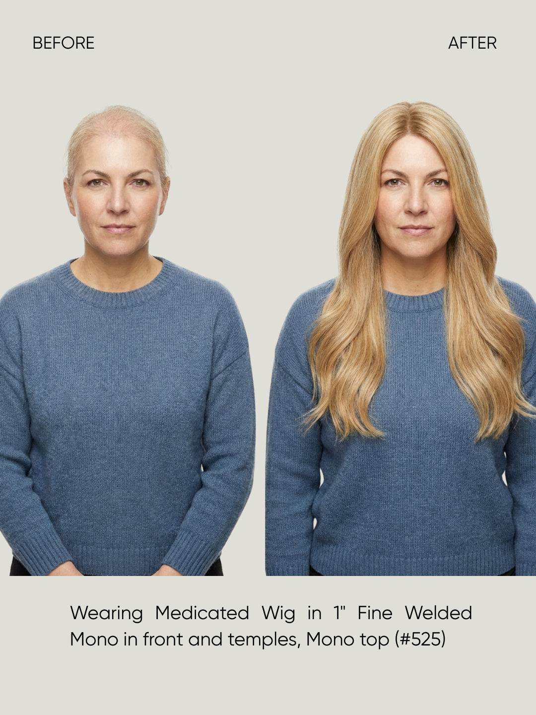 Britta Fine Welded Mono Top Medical Wig