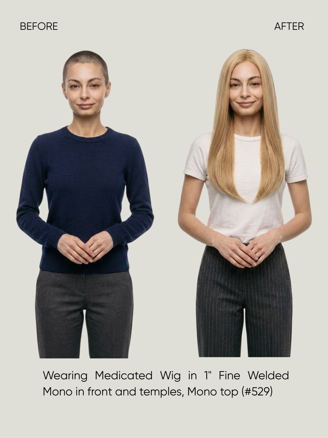 Britta Fine Welded Mono Top Medical Wig