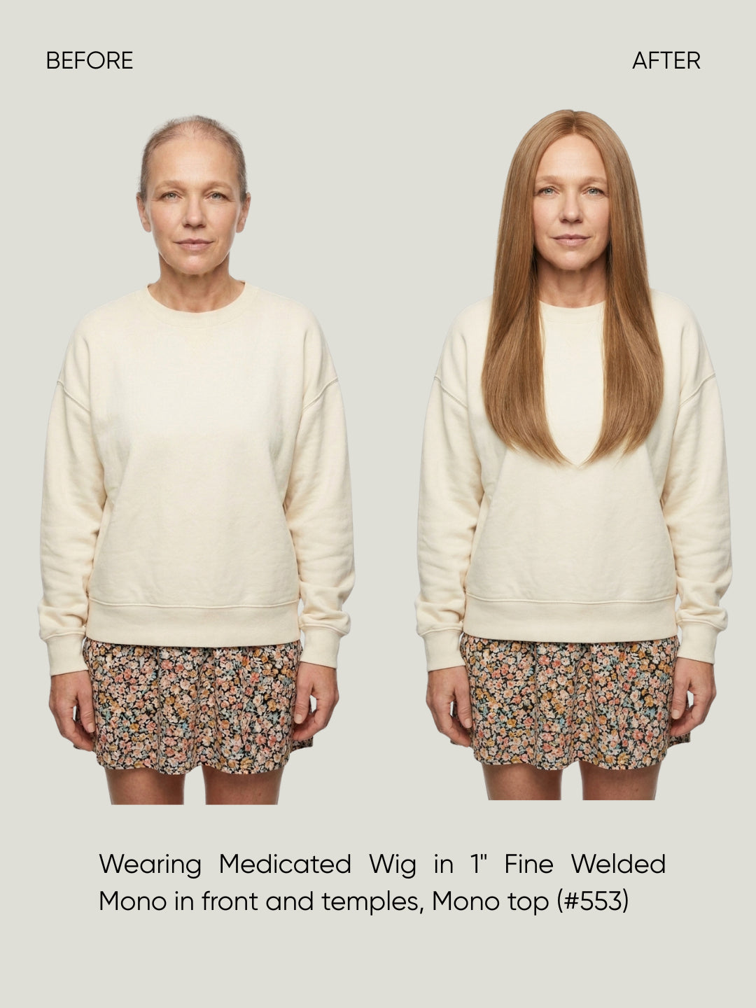 Britta Fine Welded Mono Top Medical Wig