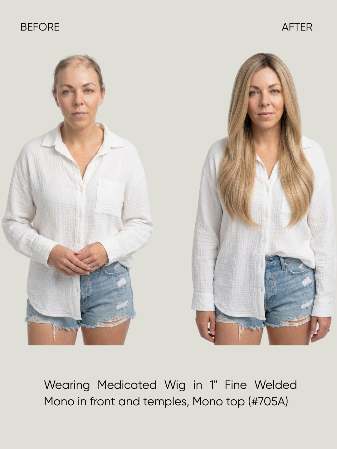 Britta Fine Welded Mono Top Medical Wig