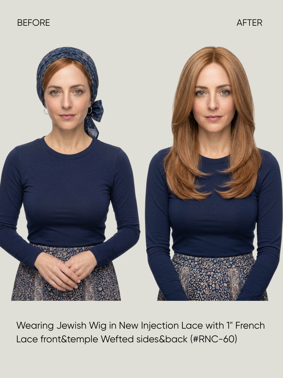 EW40 French Lace Front European Virgin Hair Medical Wig