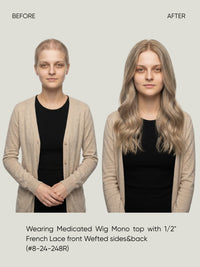 Mono Top with 1/2" French Lace Front and Wefted Sides & Back Medical Wig