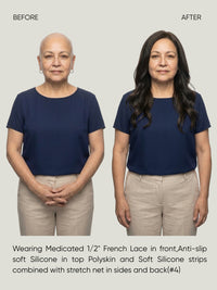 Mono Top French Lace Medical Wig
