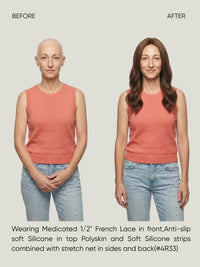Mono Top French Lace Medical Wig