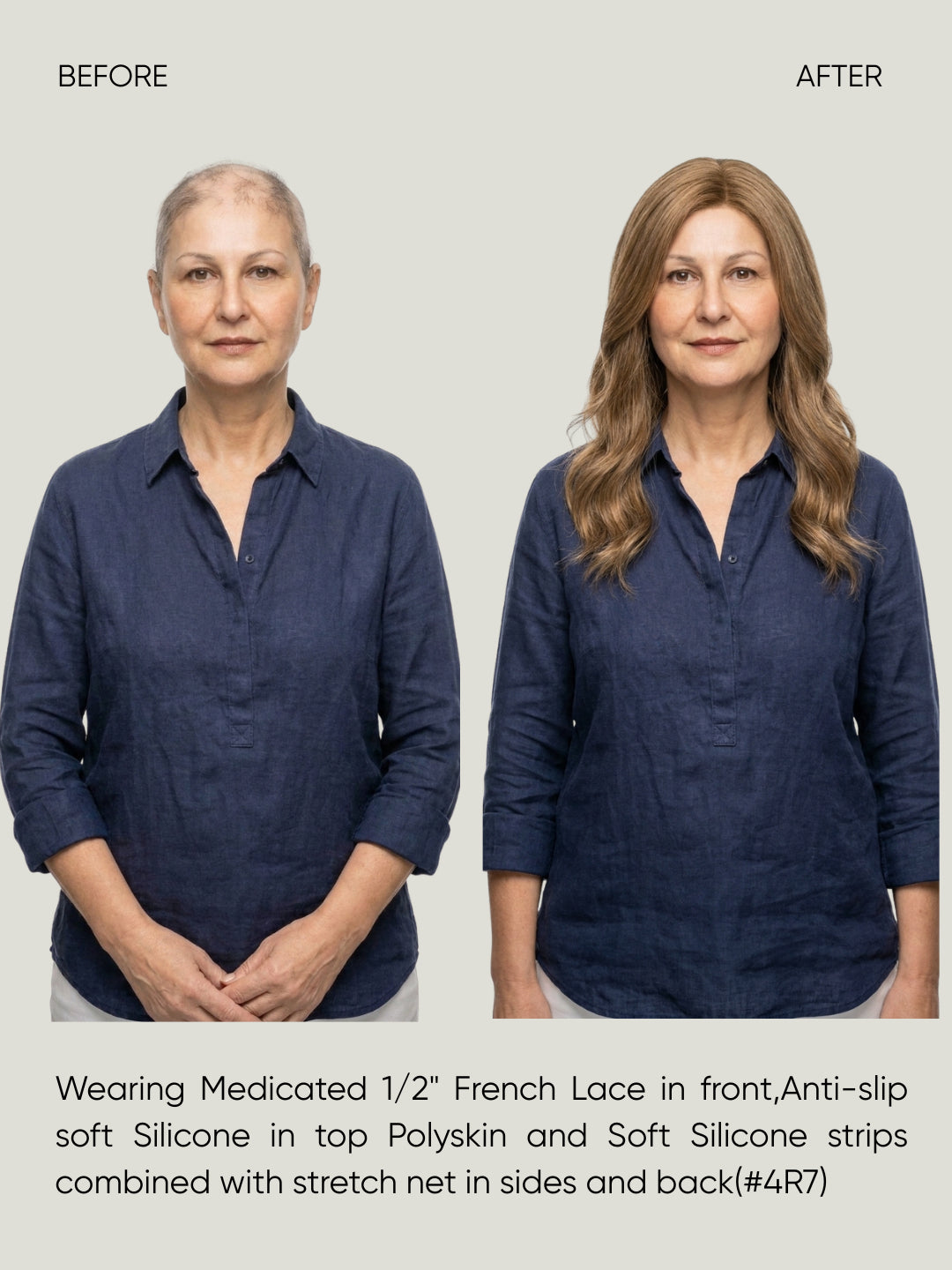 Mono Top French Lace Medical Wig