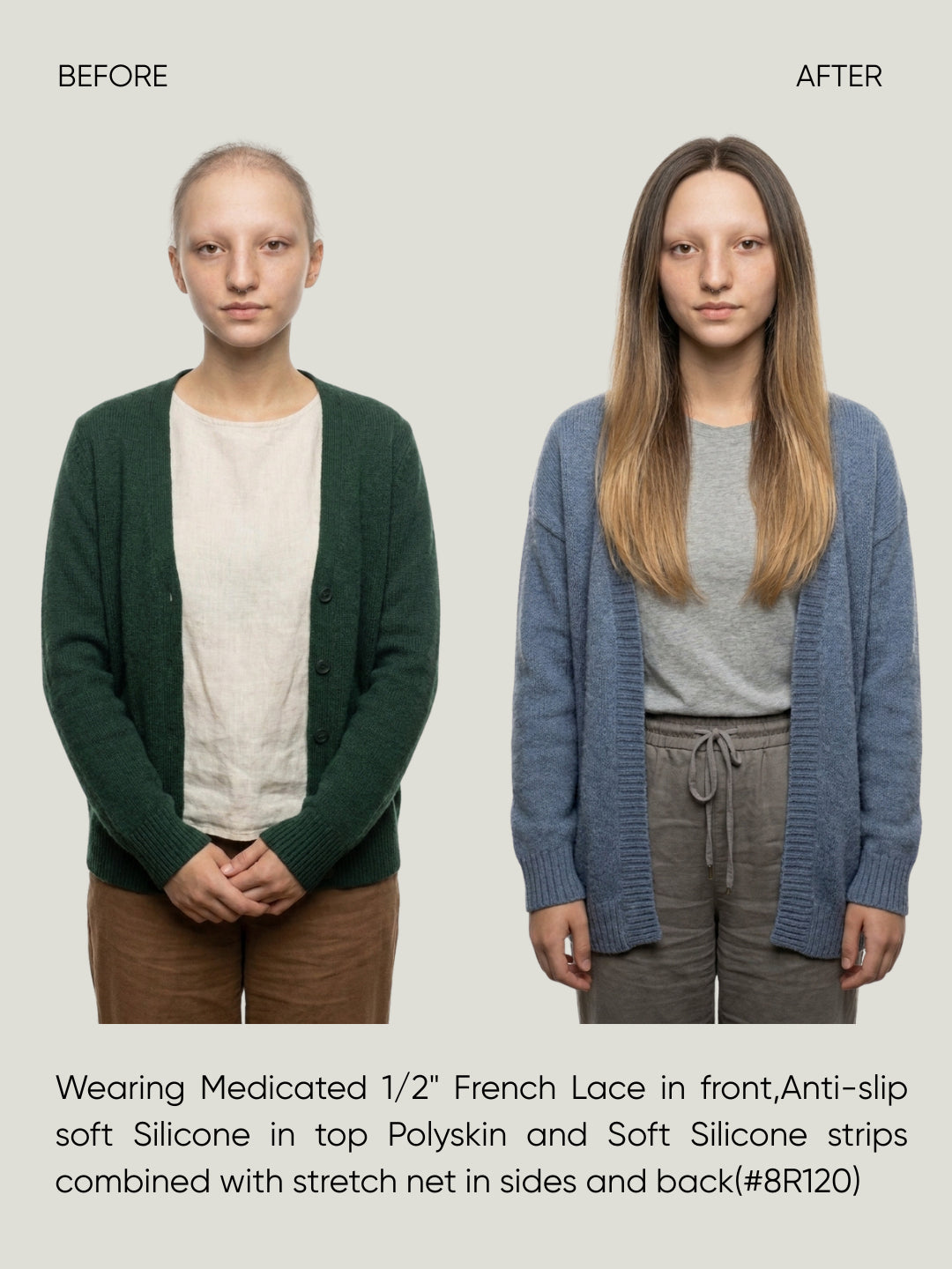 Mono Top French Lace Medical Wig