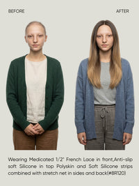 Mono Top French Lace Medical Wig