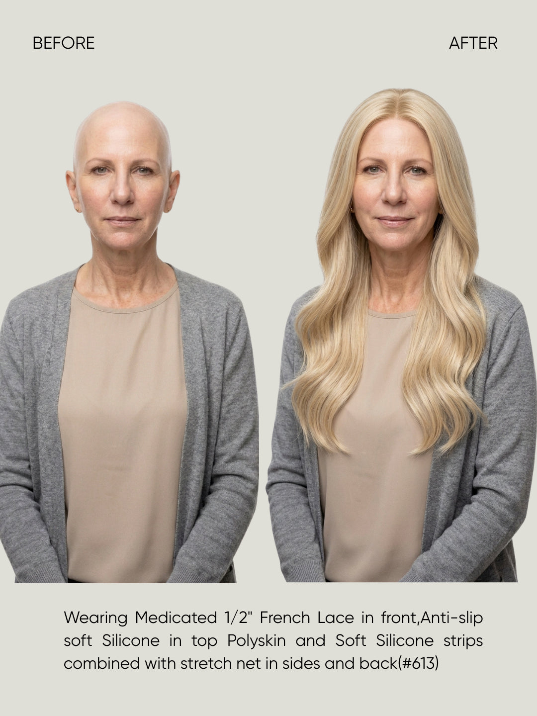French Lace Silicone Medical Wig