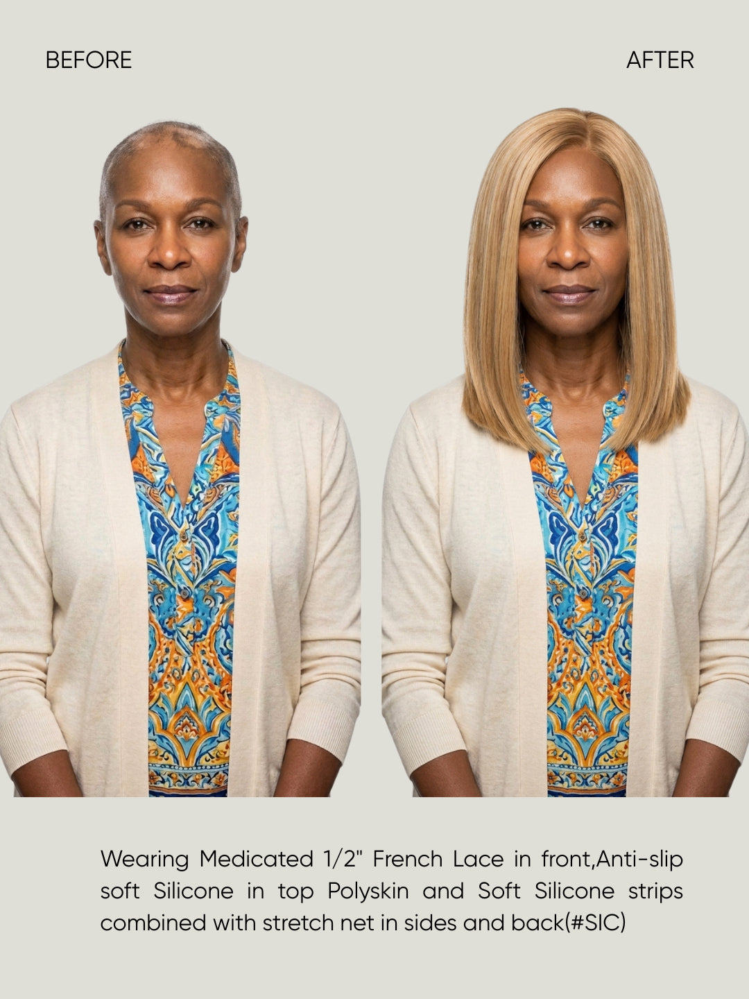 French Lace Silicone Medical Wig