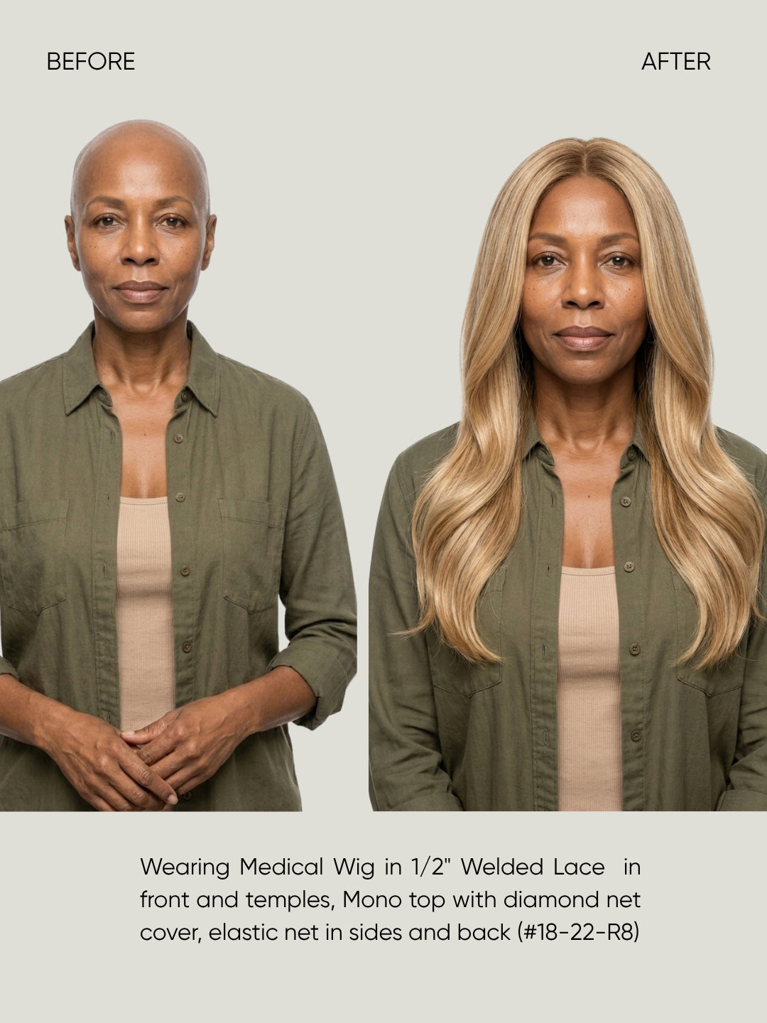 1/2" Welded Lace Front Top with Diamond Net Cover Medical Wig
