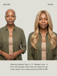 1/2" Welded Lace Front Top with Diamond Net Cover Medical Wig