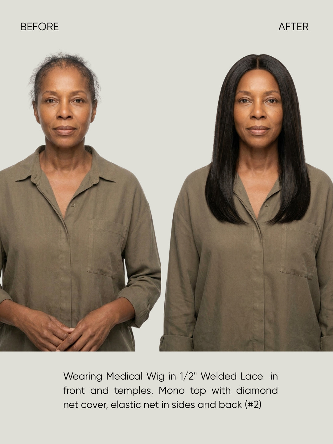 1/2" Welded Lace Front Top with Diamond Net Cover Medical Wig