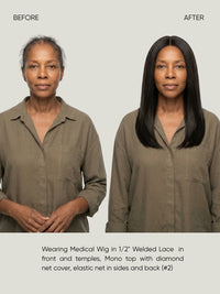 1/2" Welded Lace Front Top with Diamond Net Cover Medical Wig