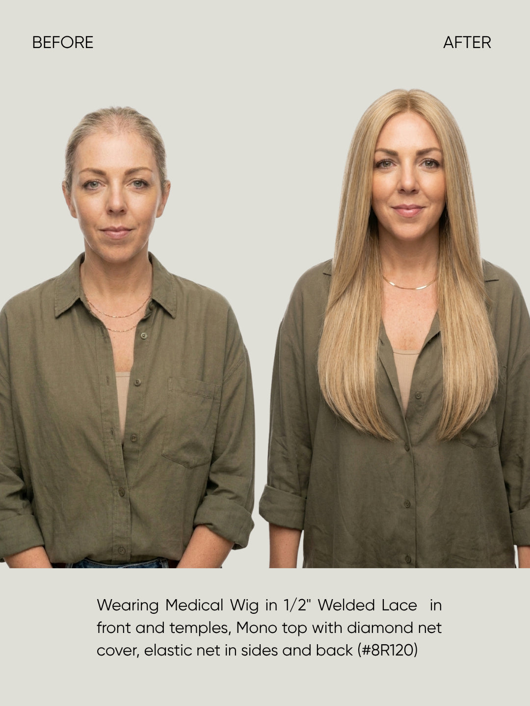 1/2" Welded Lace Front Top with Diamond Net Cover Medical Wig