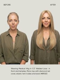 1/2" Welded Lace Front Top with Diamond Net Cover Medical Wig